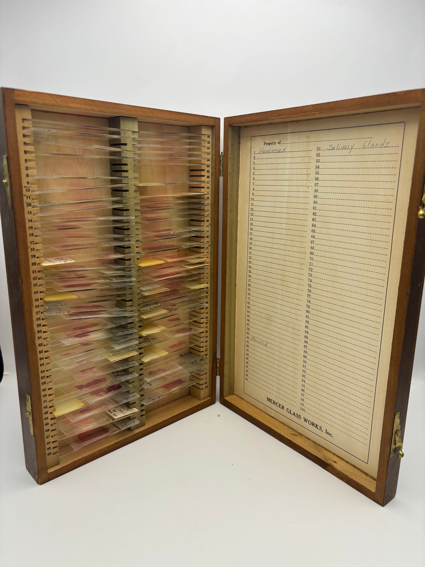 Vintage Wooden Box of Glass Slides of Blood Samples. Real Life Dexter Stuff!