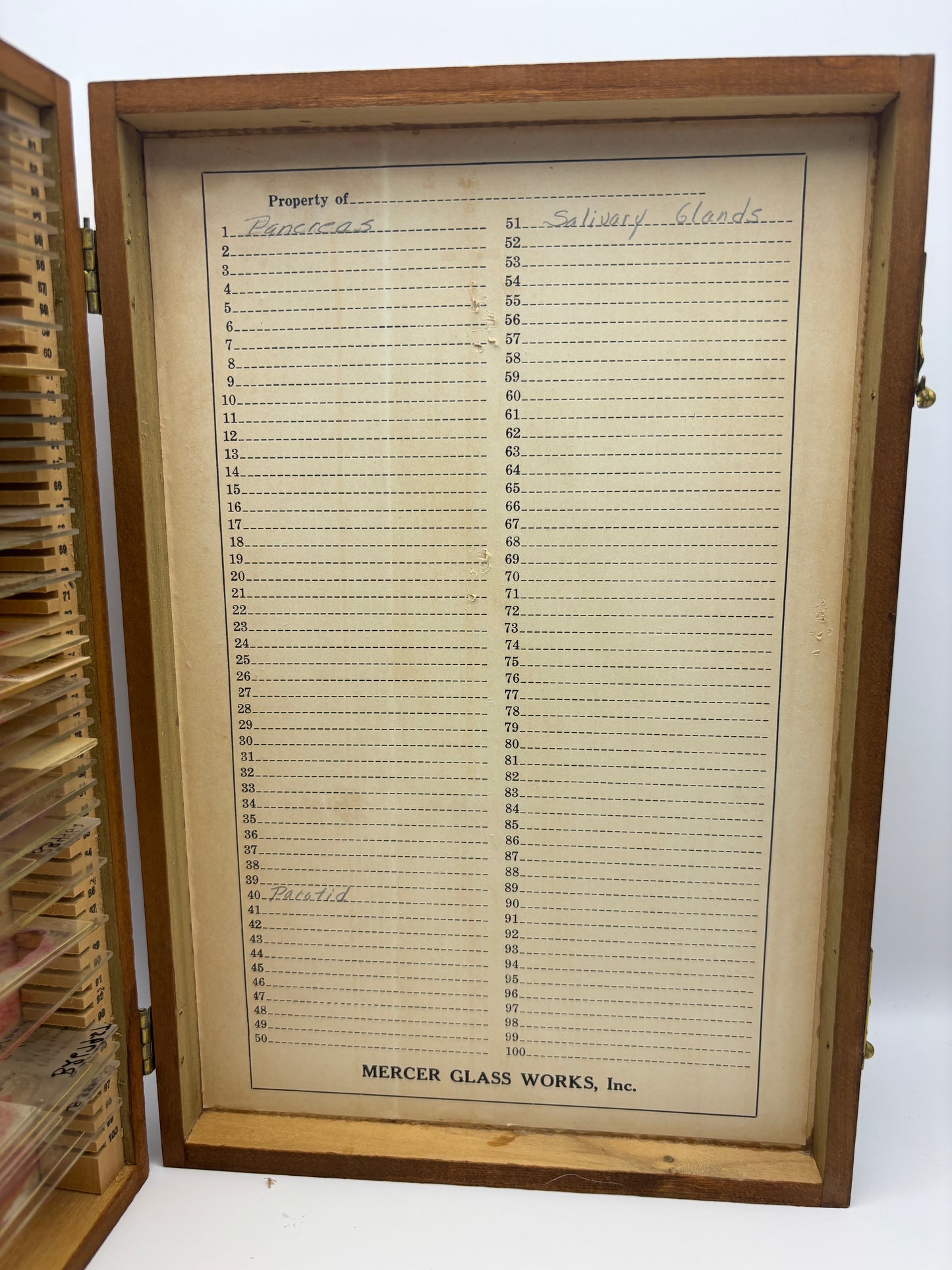 Vintage Wooden Box of Glass Slides of Blood Samples. Real Life Dexter Stuff!