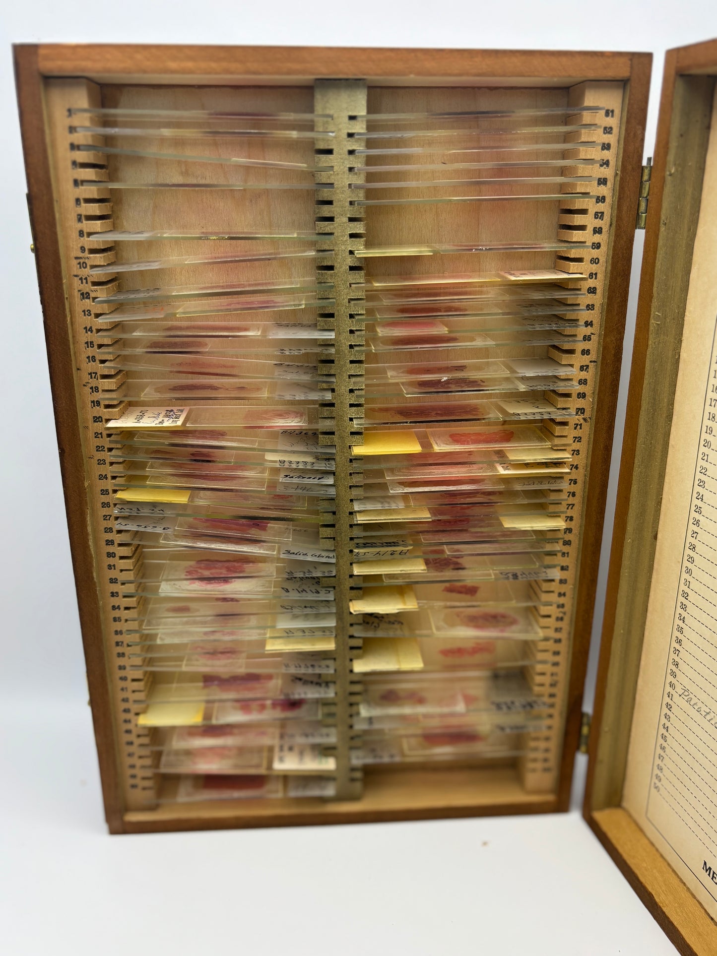 Vintage Wooden Box of Glass Slides of Blood Samples. Real Life Dexter Stuff!