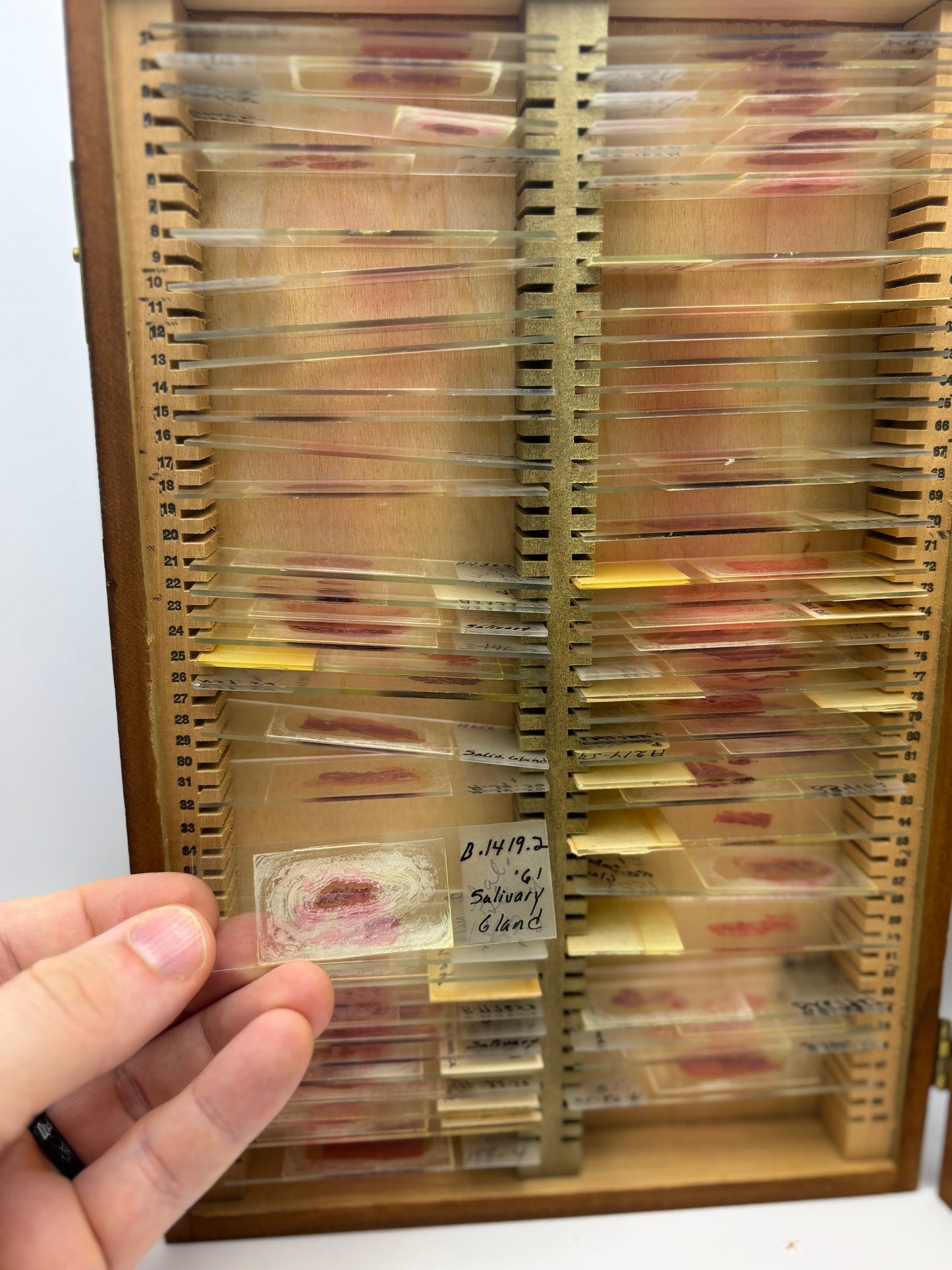 Vintage Wooden Box of Glass Slides of Blood Samples. Real Life Dexter Stuff!