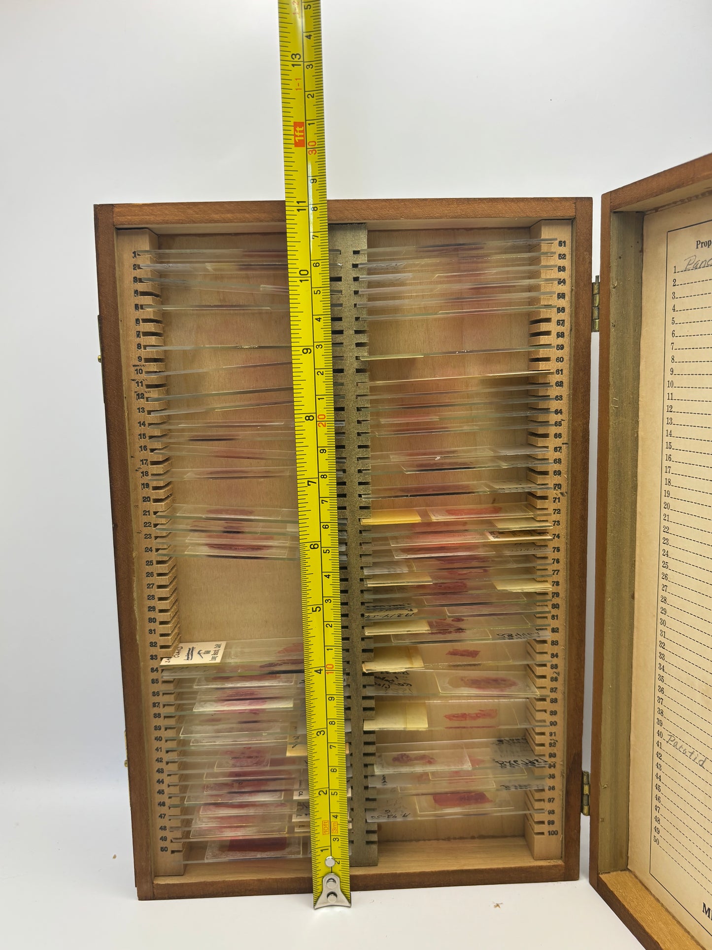 Vintage Wooden Box of Glass Slides of Blood Samples. Real Life Dexter Stuff!